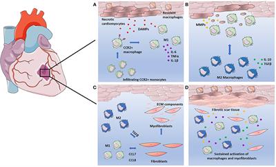 The Role of Macrophages in the Infarcted Myocardium: Orchestrators of ECM Remodeling